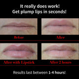 Fullips Lip Plumping Enhancer – Ovalado (Tamaño Mediano (Plus redonda grande Bonus & regalo extra.)
